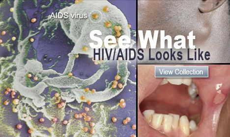 photo image-If-your-sign-is-she-infected-HIVPositive-hiv-aids_zps6c99aeeb.jpg